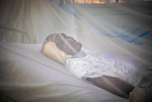 MSF support of burnt patients in September explosion -53