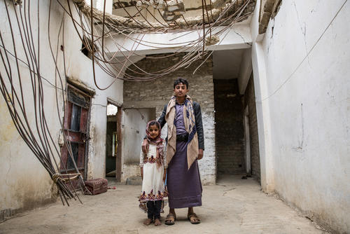 North Yemen: living under daily coalition airstrikes