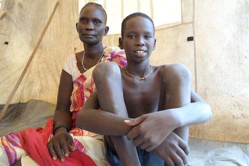 MSF Malaria Campaign in Bentiu, South Sudan