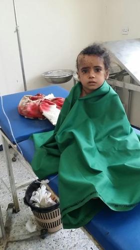 Rocket Destruction Taiz Yemen