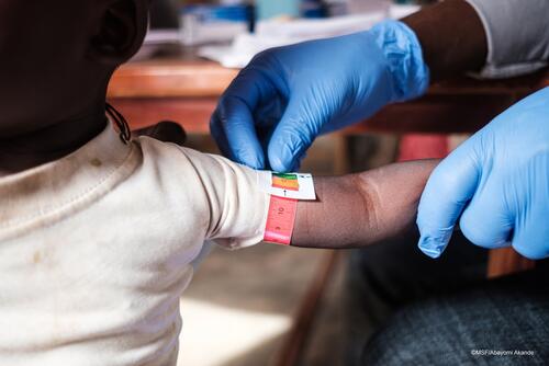 A child being screened for malnutrition in Anka