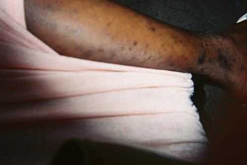 “I took a picture of my calf to show what happens when AIDS progresses in the body. My pastor told me to stop my medication and that with a prayer fast, I would be healed. But I ended up hospitalized at
CHK. The others from the club came to see me—it really touched me. Now, when others in the club aren’t serious about their treatment, I show them my
calves”. (F,. 22 years)

Through fifty photographs, ten young people share their daily lives, hopes, and
challenges, offering a rare and intimate perspective on a reality often kept invisible.
This exhibition is based on anthropological research conducted in 2024 within four
HIV+ youth clubs in Kinshasa, supported by Médecins Sans Frontières and Jeunesse
Espoir. These clubs offer medical and psychosocial support, helping adolescents
break isolation and confront stigma.
As part of the project, ten participants used disposable cameras to document their
lives and express themselves freely through a method called Photovoice. Most were
born with HIV, and many have lost one or both parents.
Together, they created a mosaic of personal and collective stories — a way to show,
through their eyes, what it means to grow up with HIV.
This exhibition honors their strength, their voices, and their right to define their
own path.