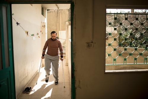 Omar Al Balkhim, surviving the wounds of Syria