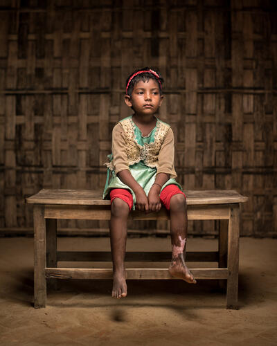 Mental Health: Rohingya Trauma and Resilience - Yasamin Story