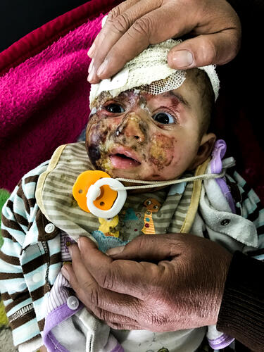 Mosul : Qayyarah hospital