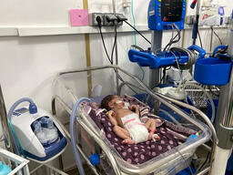 Premature Neonate on High Flow Oxygen Device