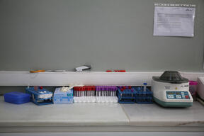 (DR-TB) Patient Diagnose and Treatment | laboratory