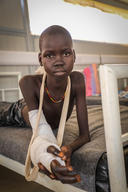 Awien Maguor, a snakebite patient in the post-op ward