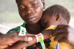 Malnutrition and malaria in Manono health zone