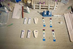 Malaria and malnutrition in South Sudan, Bentiu PoC, Sept 2015 Brendan Bannon.