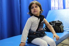 little Iman with burn injuries in Khan Younis MSF Clinic