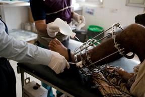 MSF in Al Dhale and Taiz, Yemen. July 2015