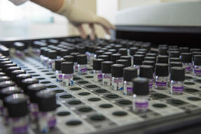 TB treatments yield promising results in the Chechen Republic
