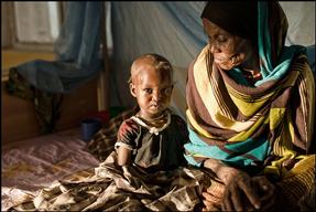 malnutrition in the pastoralist community of Fiq