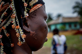 Emergency intervention following violence and displacement in Western DRC