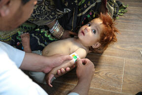 MSF Ambulatory Therapeutic Feeding Center | Triage Room