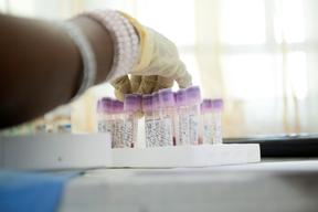 Lead poisoning and gold processing in Zamfara state, Nigeria, Ap