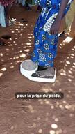 Visite de la clinique mobile à Kaya, Burkina Faso