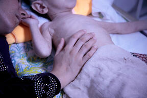 Inpatient Therapeutic Feeding Centre (ITFC) at Herat Regional Hospital