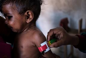 Malnutrition in Bihar, India