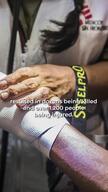 (ENG) REEL Treating people injured during the protests in Lima