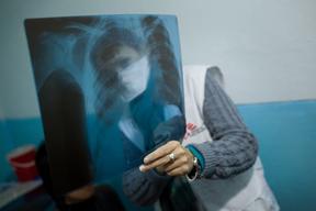 Kyrgyzstan - Figthing MDR-TB