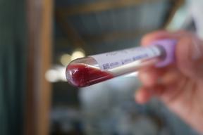 MSF Malaria Campaign in Bentiu, South Sudan