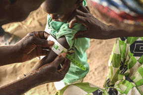 Fighting malnutrition through preventive approach – Parents MUAC