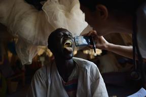 Hepatitis E outbreak in Batill refugee camp, Feb 2013