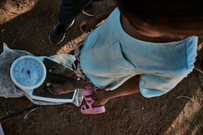 Malnutrition emergency: mobile clinic in Ranobe