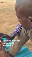 VERTICAL VIDEO – Saving children’s lives with bead necklaces in Mali – ES