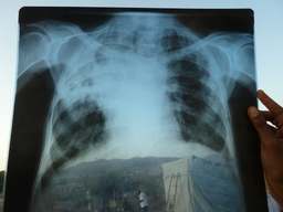 Telemedicine Ethiopia