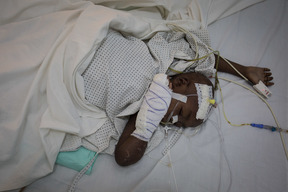 Emergency surgery in Maroua, North Cameroon