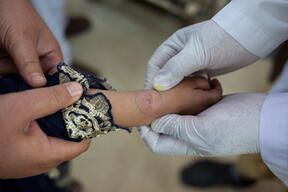 Cutaneous Leishmaniasis Treatment | Lesion