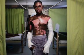 Treating Burn and Trauma Victims in Haiti