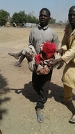 Victims of bombing on a displaced camp in Rann, Nigeria