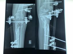 Surgeries in Al-Awda hospital