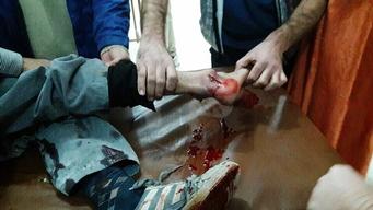 Al Zafarana Hospital Barrel Bombed - 28Nov2015