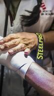(ESP) REEL Treating people injured during the protests in Lima