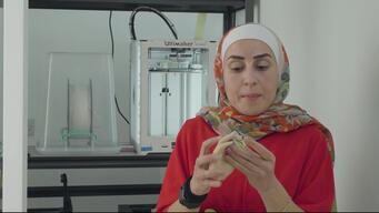 3D Printing Project in Amman RSP hospital (INT)