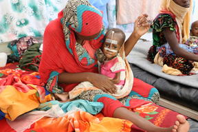 MSF IN CHAD: TACKLING MALNUTRITION IN AM TIMAN