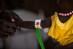 Malaria and malnutrition in South Sudan, Bentiu PoC, Sept 2015 Brendan Bannon.
