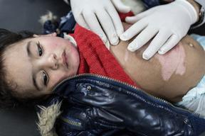 MSF post-op clinic in Gaza City