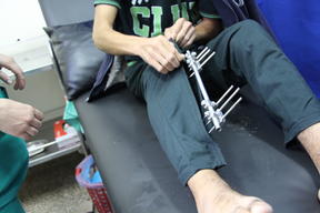 Gaza - Lifelong impact of gunshot injuries