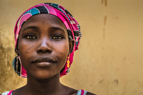 Vesico Vaginal Fistula (VVF)