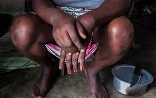 Key populations, peer-led HIV and SRH services