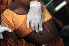 Treating kala azar HIV co-infection in Patna, Bihar