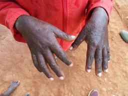 Mandro hands