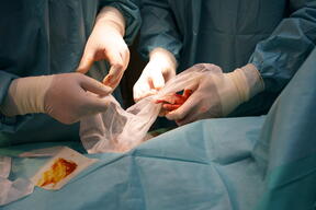 Burn Care in Gaza