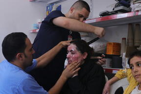 Essayage d’un masque compressif sur une patiente brûlée au visage à Gaza